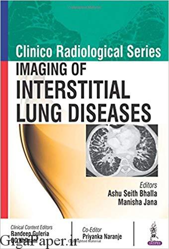 دانلود کتاب  Imaging of Interstitial Lung Diseases